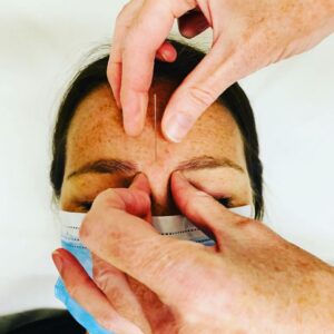 image of acupuncture