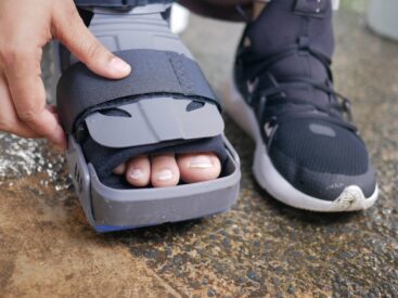 acupuncture for injury recovery and pain relief